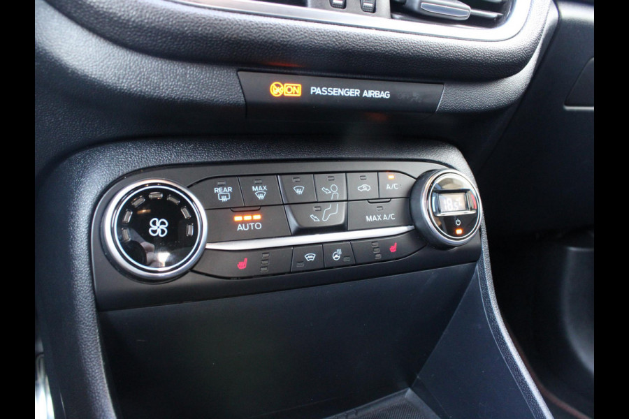 Ford Fiesta 1.0 EcoBoost ST-Line X